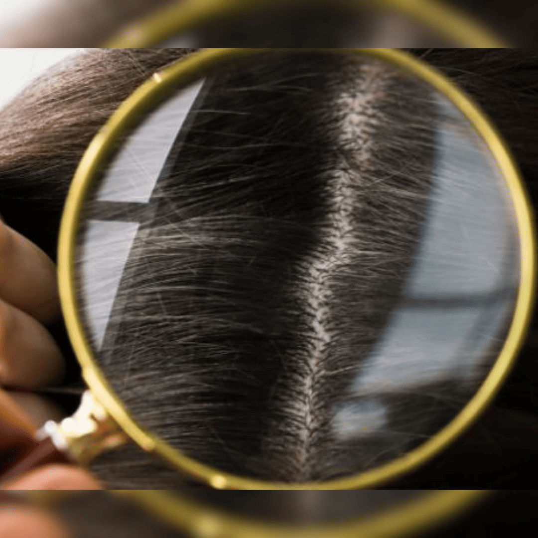 Hairfall Reduction Diet Plan  Manufacturer and Supplier in India